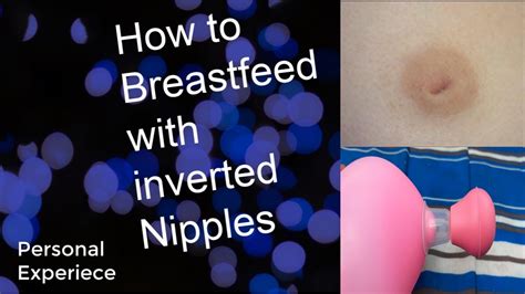 inverted nipple sex|inverted nipples Search